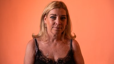 Leven met huidkanker - het verhaal van Danielle